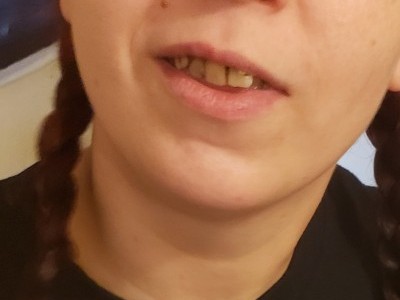 In desperate need of dental surgery