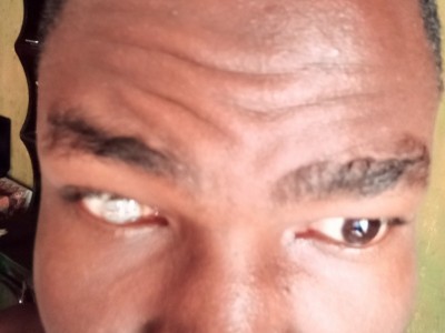 Protestic eye surgery