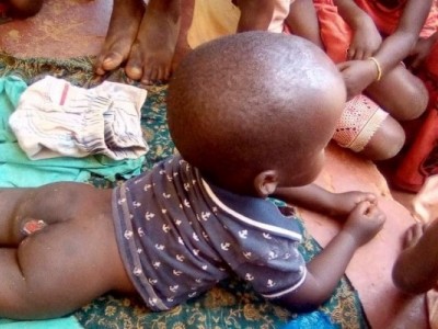 Help Sulaiman undergo surgery