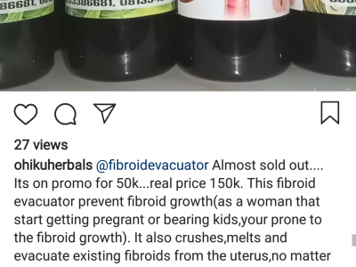 Raising money for fibriod surgery
