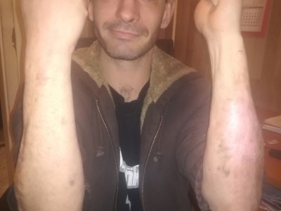 Help Heal the Scars