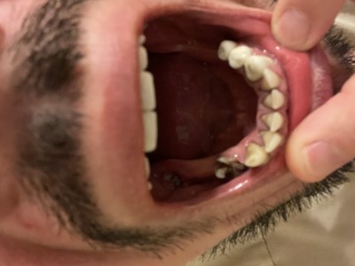 dental treatment