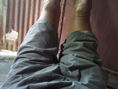 MELAWAN SIKSAAN HERNIA