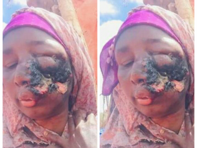 HELP This mother suffered a serious illness-