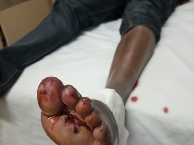Raise money to pay hospital bill