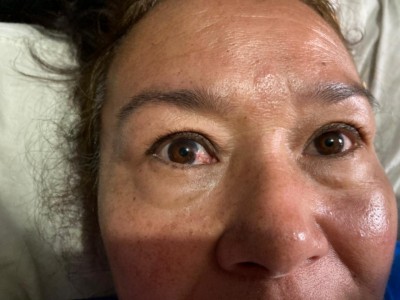 Help my mother to recover her eyesight