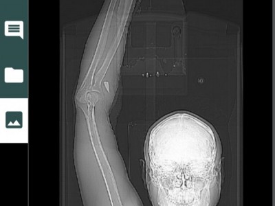Breaking Chains! - Handicapped to Handy Hand!