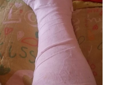 Please help me raise money for my surgery..