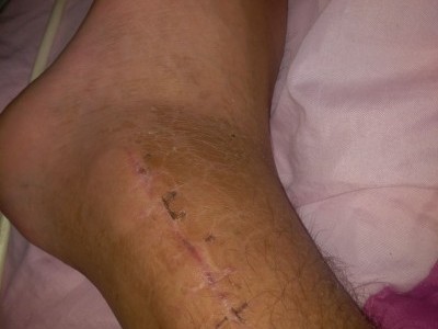 Help me walk again.