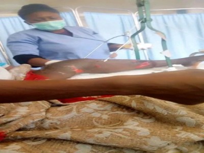 Funding for Knee Cap replacement.