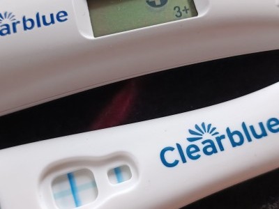 Please help our baby to have a normal life!