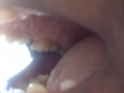 DENTAL IMPLANT