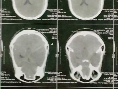 Mum of two kids is dying