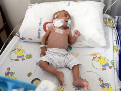 Saving a life of Eymen baby