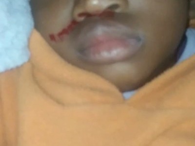 Raising funds for medical aid support