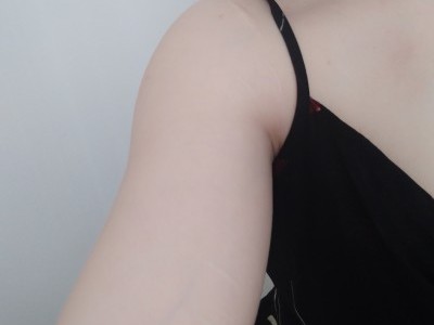 Help me get rid of my self harm scars !