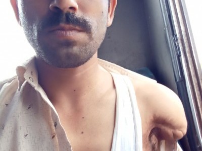 एक हाथ और पैर से विकलांग प्लीज हेल्प
