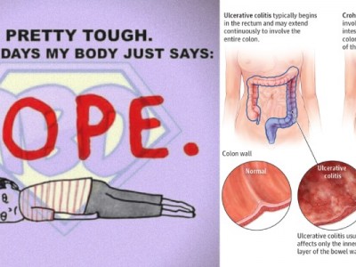 Help IBD & IBS Patients!