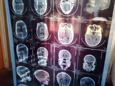 Help Jennifer treat her deep head injury