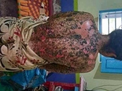 Help to get medicine