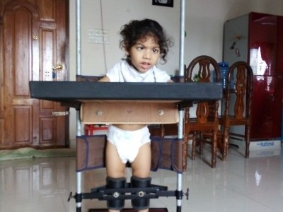 Stem Cell Therapy for Cerebral Palsy