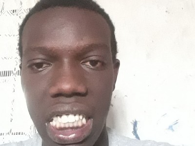 Teeth alignment