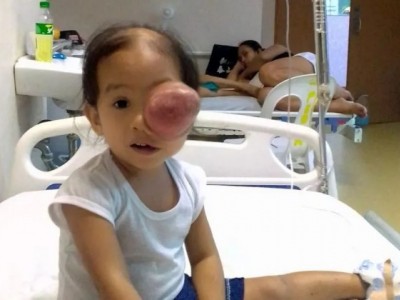 Please help fund baby rita's operation