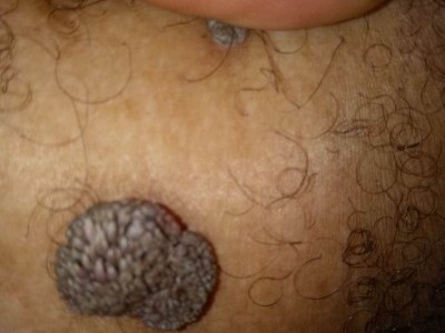 Help me go through this surgical operation