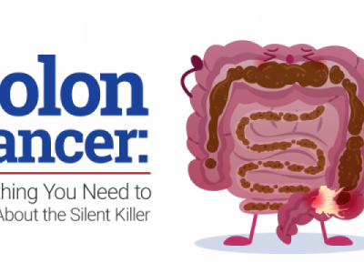 Colon cancer treatment