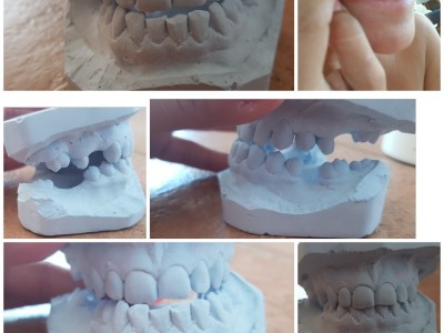 Dental problems