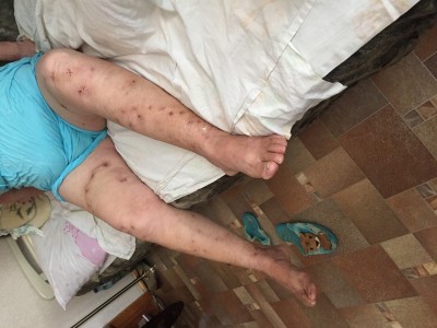 Помощь на операцию. Маме