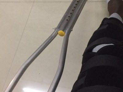 KNEE SURGERY AND HYPERHYDROSIS TREATMENT
