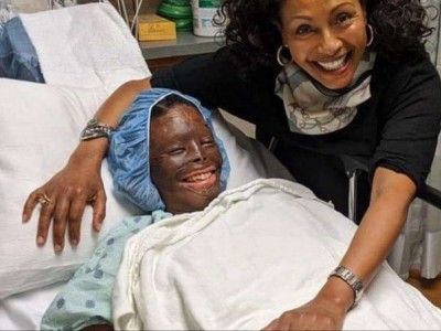 Help Mirah Abdul Nasir: Acid Attack Survivor
