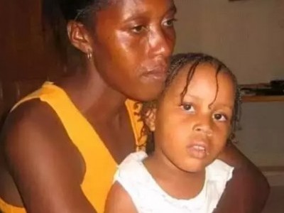 Saving an African woman from colon cancer
