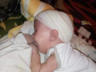 Medical funds for lila