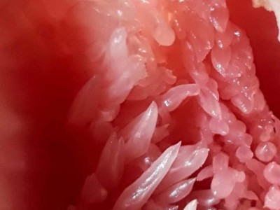 Torn tissue