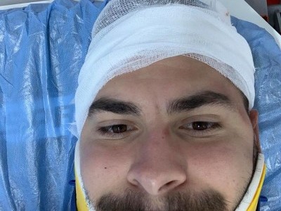 Car crash survivor