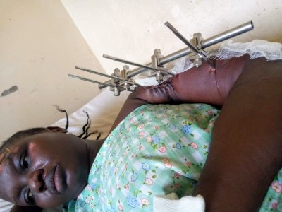 Medical expenses