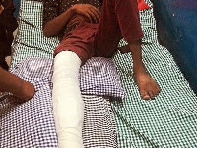 Need help for my friend operation