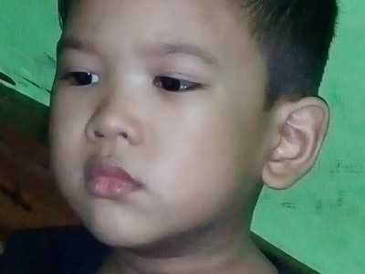 My baby suffering brain tumor.Please help.