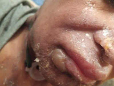 Help me, my mother has cancer