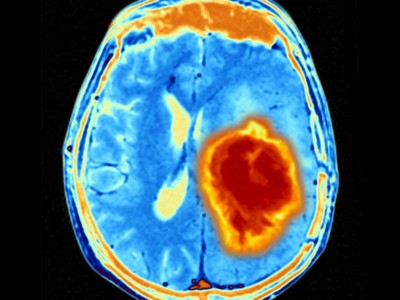 Money for chemotheraphy