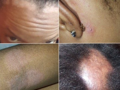 Shanoya's fight with Lupus