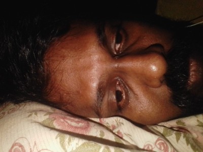 Urgent Surgery Help Needed