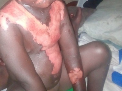 Help raise medical bills