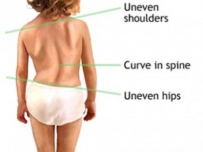 Postural Status Measurement