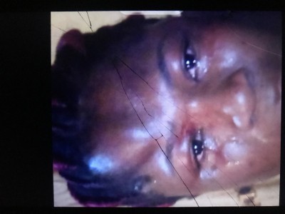 Save funmilayo’s life